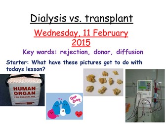 Dialysis and transplant- kidneys