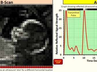Ultrasound Interactive Spreadsheet