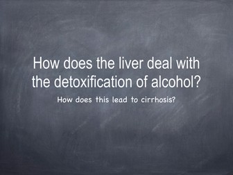 Cirrhosis presentation