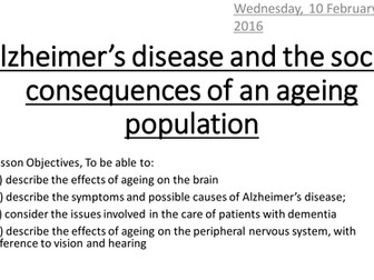 OCR Human Biology Third Age Alzheimer's