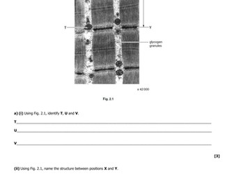 OCR Questions on Muscle and Brain