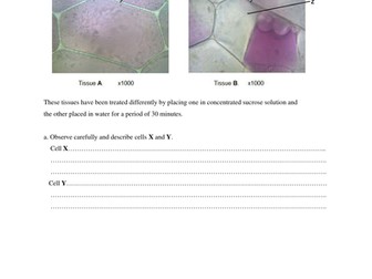 Osmosis, Turgidity and Plasmolysis in Plant Cells