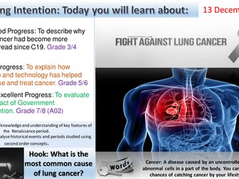 Medicine Through Time:  The Fight Against Lung Cancer. (Edexcel 1-9)