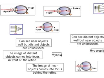 AQA GCSE Biology 9-1 (2016) The Eye