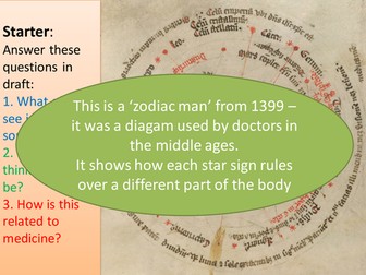 Causes of disease in Medieval Times GCSE History Edexcel specification