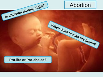 Abortion (Christian and Muslim attitudes)