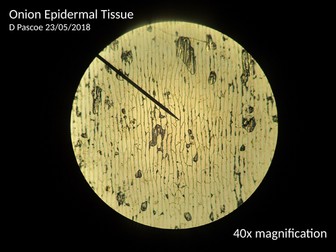 Onion and cheeks cell photos with micrometer slide