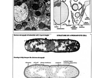 Drawing Eukaryotic & Prokaryotic Cells Using Electron Micrographs (A Level & IB)