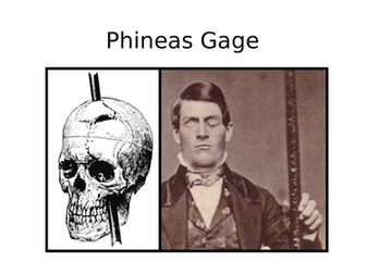 Psychology - Phineas Gage Research Task - Lobes of the Brain