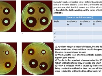 Calculating zones of inhibitions