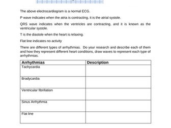 U5 B1d ECG and Arrhythmias