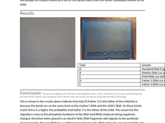 RS CP14 Act 6.3 DNA gel electrophoresis