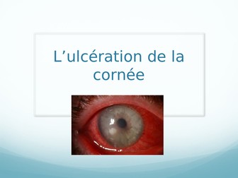 Corneal ulceration (french) powerpoint