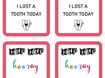 Lost tooth card