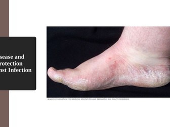 Disease and Protection Against Infection