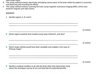 B10 The Human Nervous System (TRIPLE lessons only - Eye/ Brain) GCSE AQA