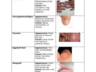Disorder of nails card sort