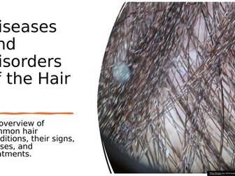 Disorders of the hair
