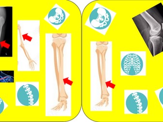 Skeleton revision game