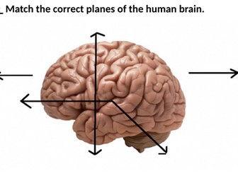 6. Contemporary Study - Schmolck 2002