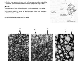 Kidney Identification
