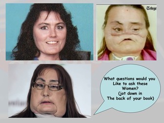 Transplant surgery and organ donation