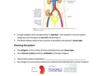 Kidney Transplants