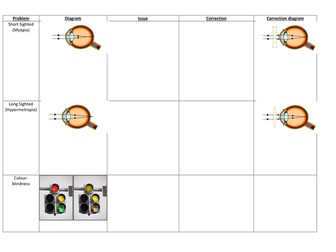 Eye conditions - OCR Gateway B1