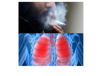 AS Biology Lung Disease workbook