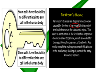 Stem cells in medicine