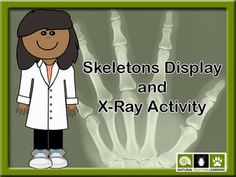 Identify the X-ray PowerPoint Activity KS2 | Teaching Resources