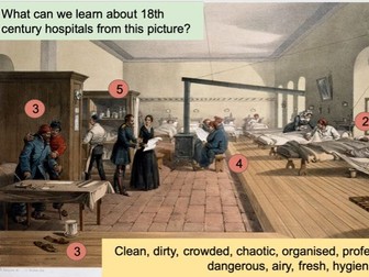 Renaissance Medicine: Lesson 7/ 8: How did hospitals change in the 18th century?