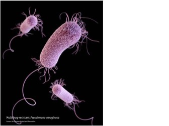 Hand Washing. Why, When and How?