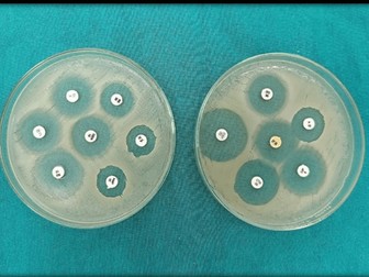 Level 3 Human Bio Unit 2 Assignment D