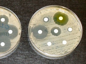Bacterial growth-Zone of inhibition