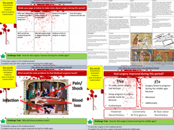 Health and the People: What was surgery like in the Medieval Period? (L4)