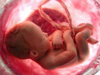 Eduqas Issues of Life and Death - Abortion