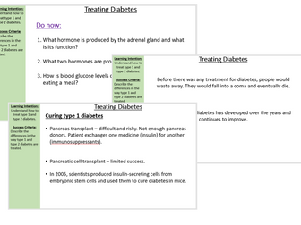 Treating Diabetes AQA B11.3