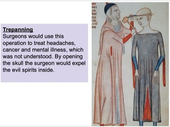 Health and the People: Lesson 5/6: How good was medieval surgery?