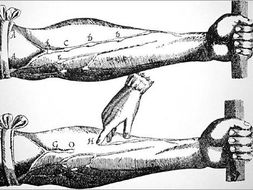 The Anatomists: Harvey and Vesalius