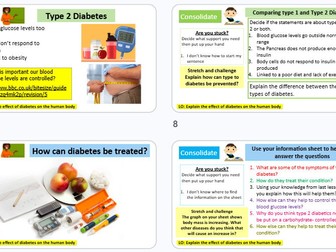 Diabetes GCSE Combined Science AQA