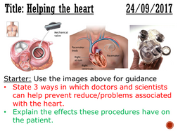 assignment on heart