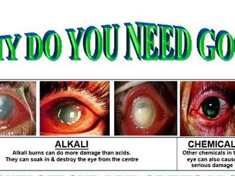 why wear your goggles safety poster