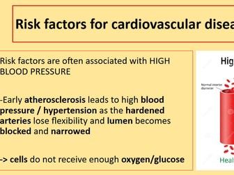 AS Biology Atherosclerosis and risk factors for CVDs (international)