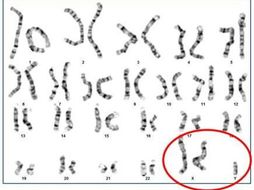 Gender and Atypical Sex Chromosomes - AQA Psychology A'Level 7182/3 ...