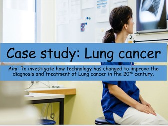 Lung cancer- Modern medicine ( Edexcel 9-1 GCSE) history.