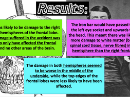 GCSE psychology - Brain, Damasio wt al 1994- Phineas Gage. | Teaching
