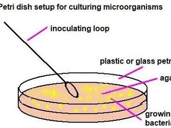 Aseptic technique worksheet for KS4