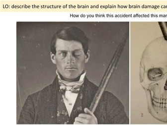 Brain structure and damage