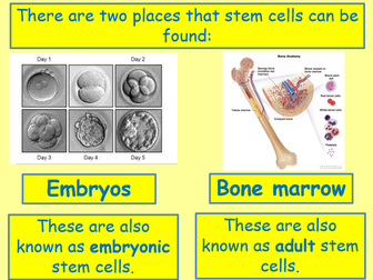 AQA Biology Unit 1 - L4 Stem Cells